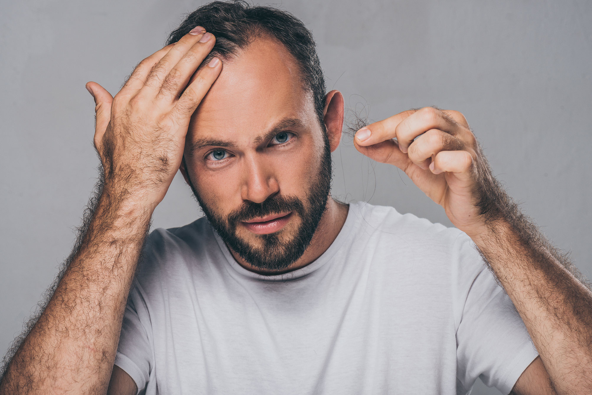 Man looking at hairline holding fallen hair